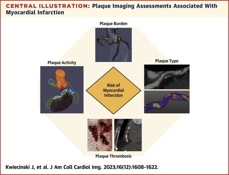 Noninvasive Coronary Atherosclerotic Plaque Imaging