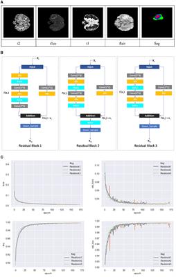 MMGan: a multimodal MR brain tumor image segmentation method