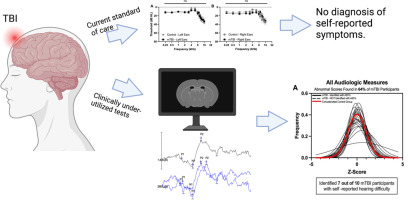 Comprehensive Behavioral and Physiologic Assessment of Peripheral and Central Auditory Function in Individuals with Mild Traumatic Brain Injury