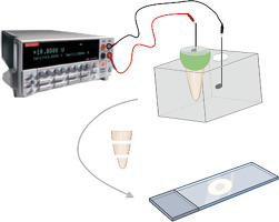 Iontophoresis use for increasing drug penetration into root canals and dentinal tubules: a proof-of-concept study