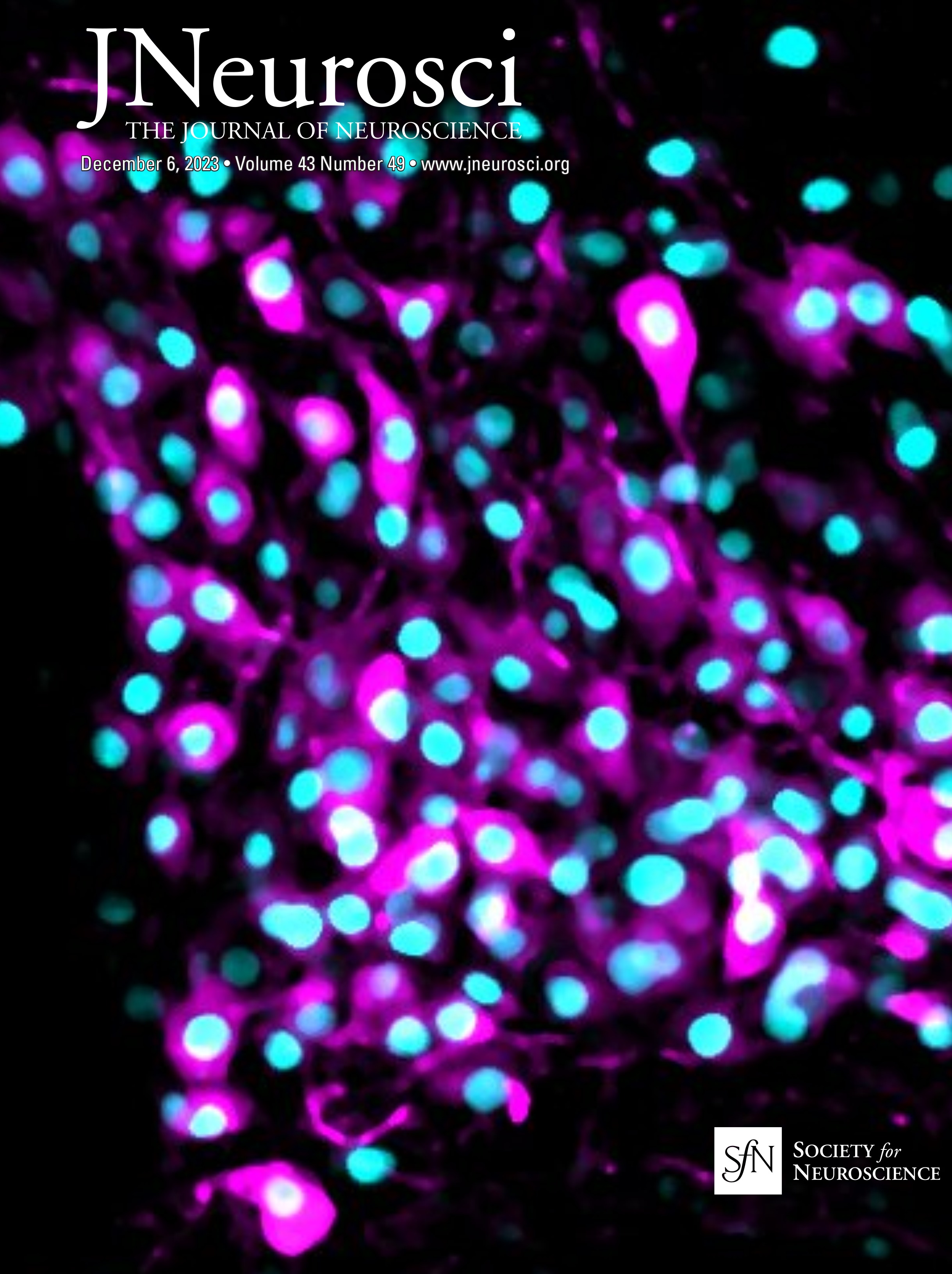 Combinatory Actions of Co-transmitters in Dopaminergic Systems Modulate Drosophila Olfactory Memories