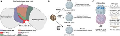 Diencephalic organoids – A key to unraveling development, connectivity, and pathology of the human diencephalon