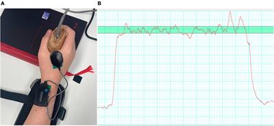 Children with developmental coordination disorder have less variable motor unit firing rate characteristics across contractions compared to typically developing children