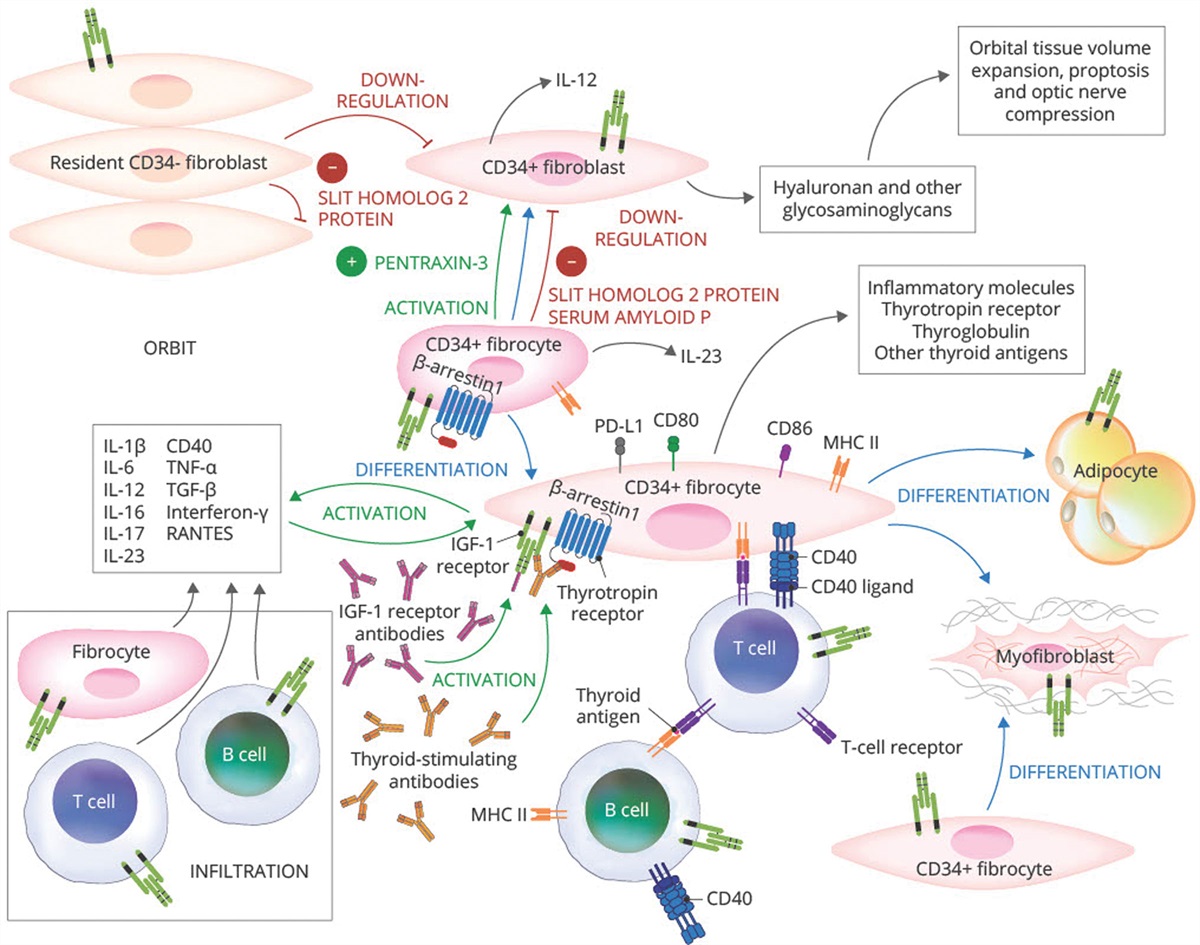 Fibrocyte Participation in Thyroid-Associated Ophthalmopathy Suggests New Approaches to Therapy