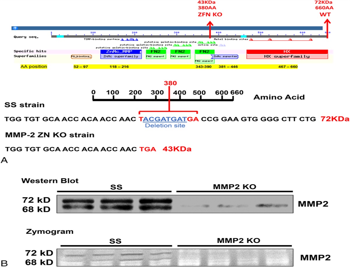 Knockout of Matrix Metalloproteinase 2 Opposes Hypertension- and Diabetes-induced Nephropathy
