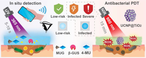Intelligent wound dressing for simultaneous in situ detection and elimination of pathogenic bacteria