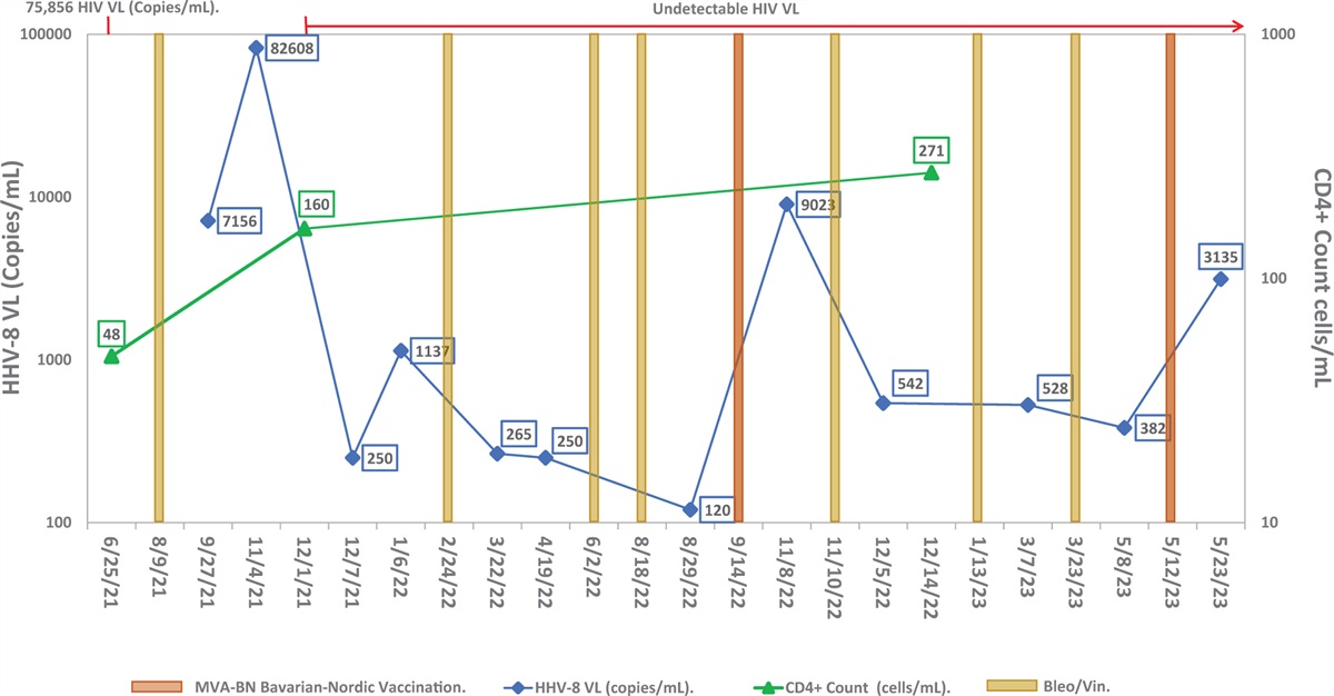 Exacerbation of Kaposi sarcoma after MVA-BN (Jynneos) vaccination in a person with HIV/AIDS