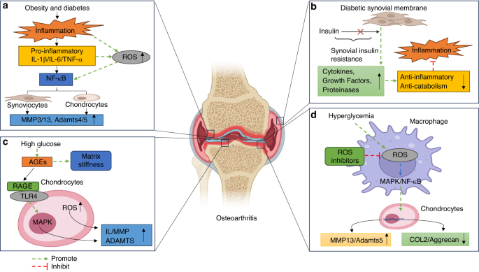 Risk of metabolic abnormalities in osteoarthritis: a new perspective to understand its pathological mechanisms