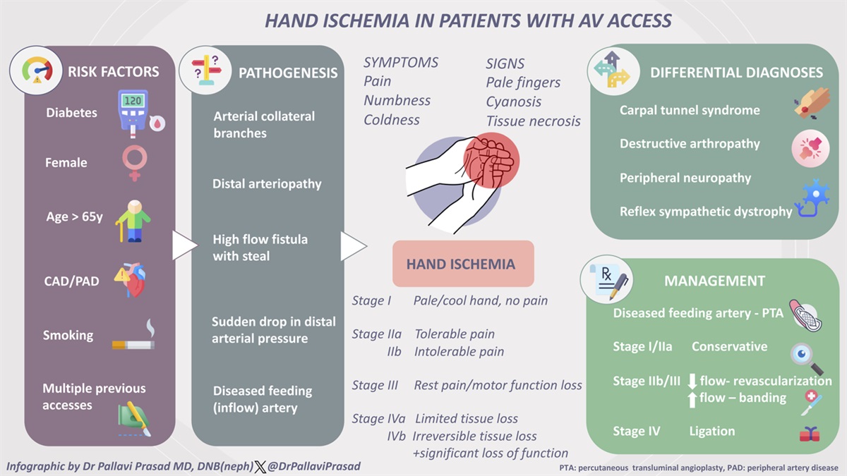 Dialysis Vascular Access and Critical Distal Ischemia