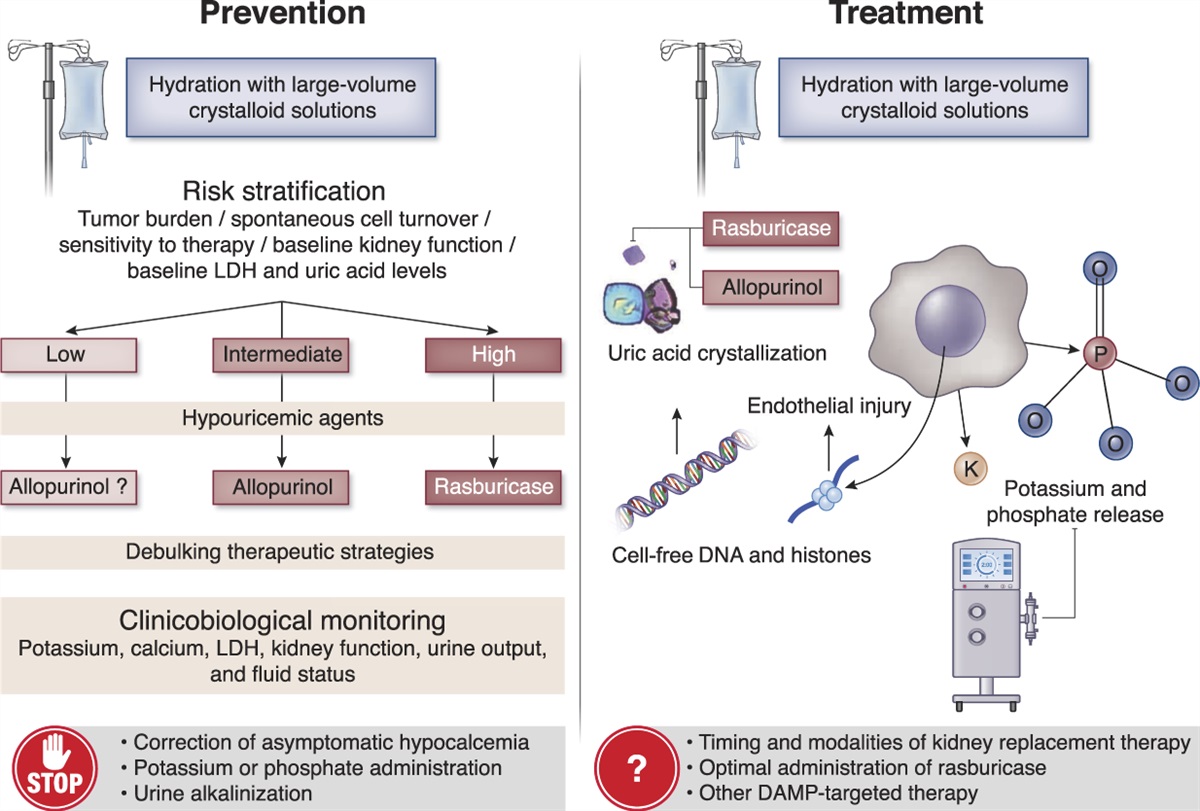 How I Treat Tumor Lysis Syndrome