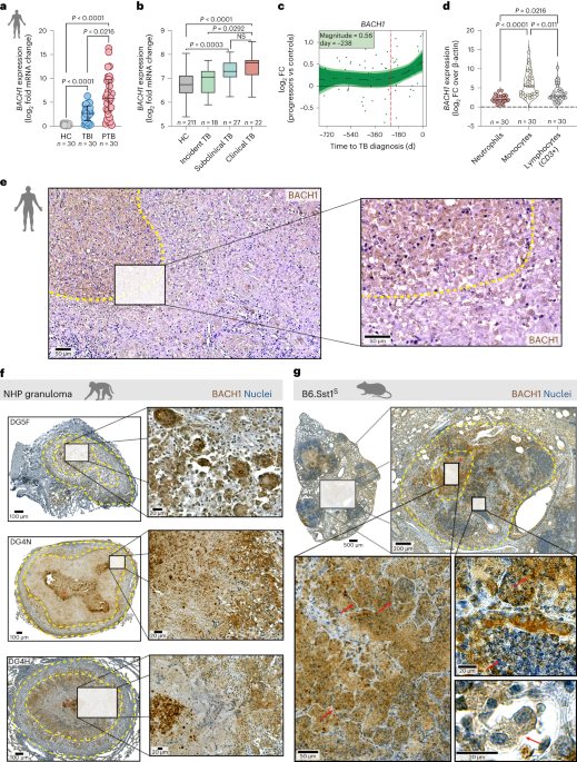 BACH1 promotes tissue necrosis and Mycobacterium tuberculosis susceptibility
