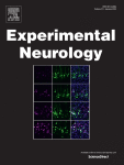 Screening of potent RIPK3 inhibitors to attenuate necroptosis and inflammation in mouse traumatic brain injury models