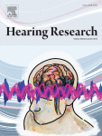Normal behavioral discrimination of envelope statistics in budgerigars with kainate-induced cochlear synaptopathy