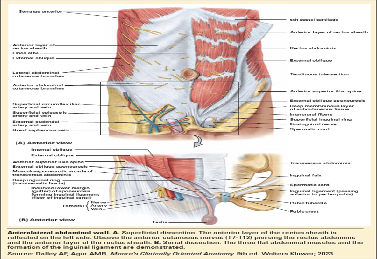 Rectus sheath hematoma