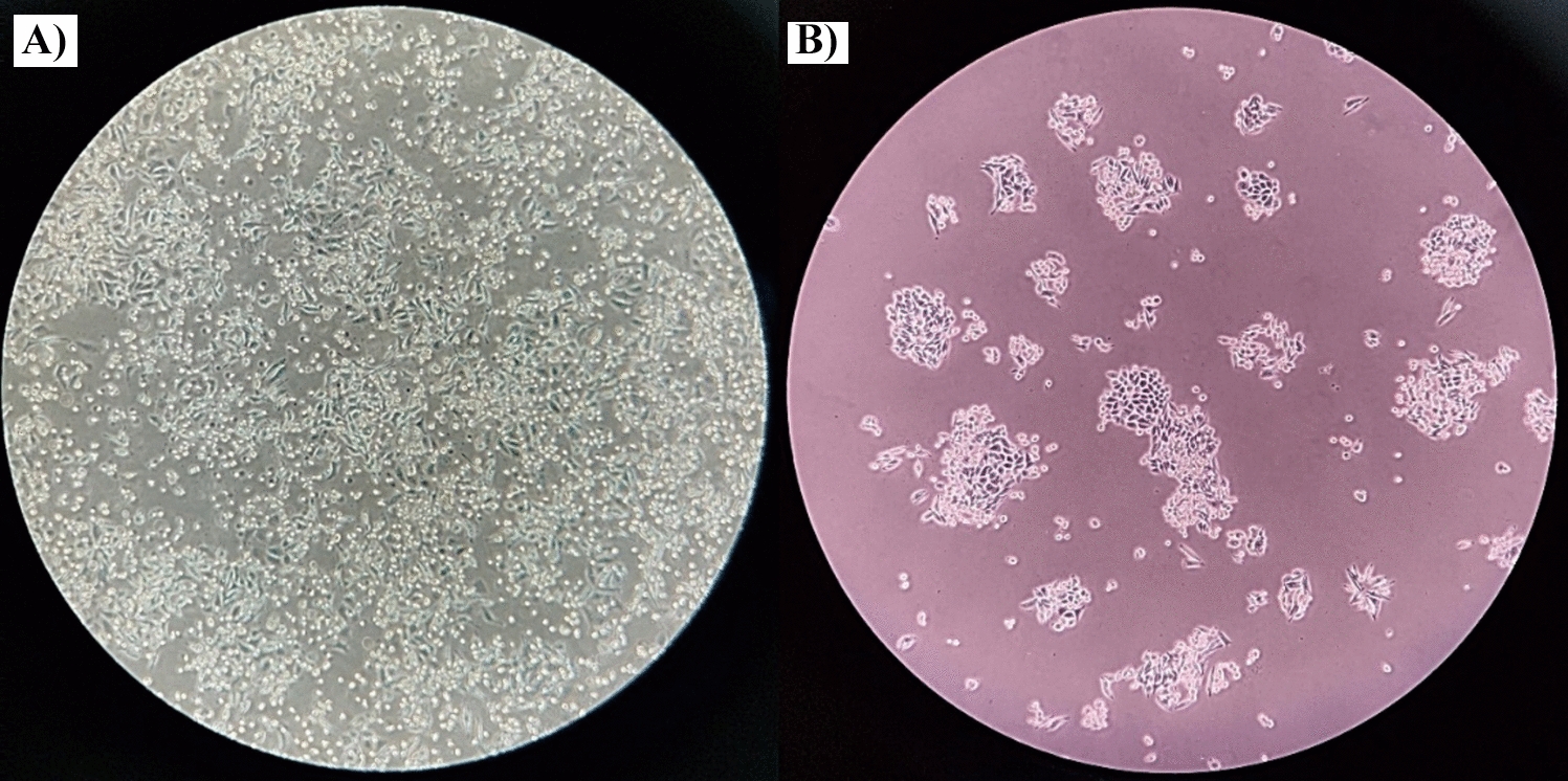 Sample Preparation of Adherent Cell Lines for Flow Cytometry: Protocol Optimization—Our Experience with SW-480 colorectal cancer cell line