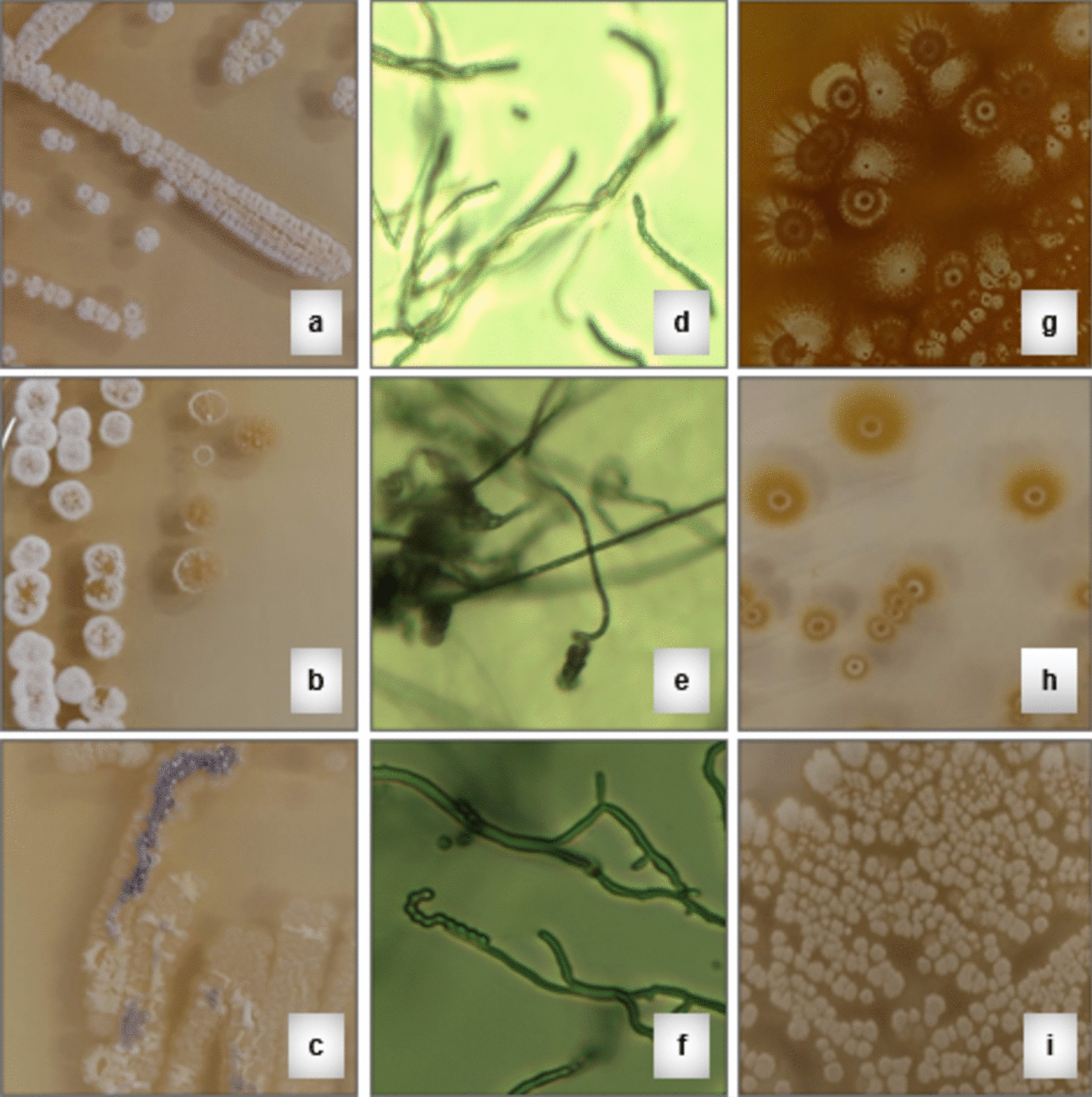 Exploring the Trends in Actinobacteria as Biological Control Agents of Phytopathogenic Fungi: A (Mini)-Review