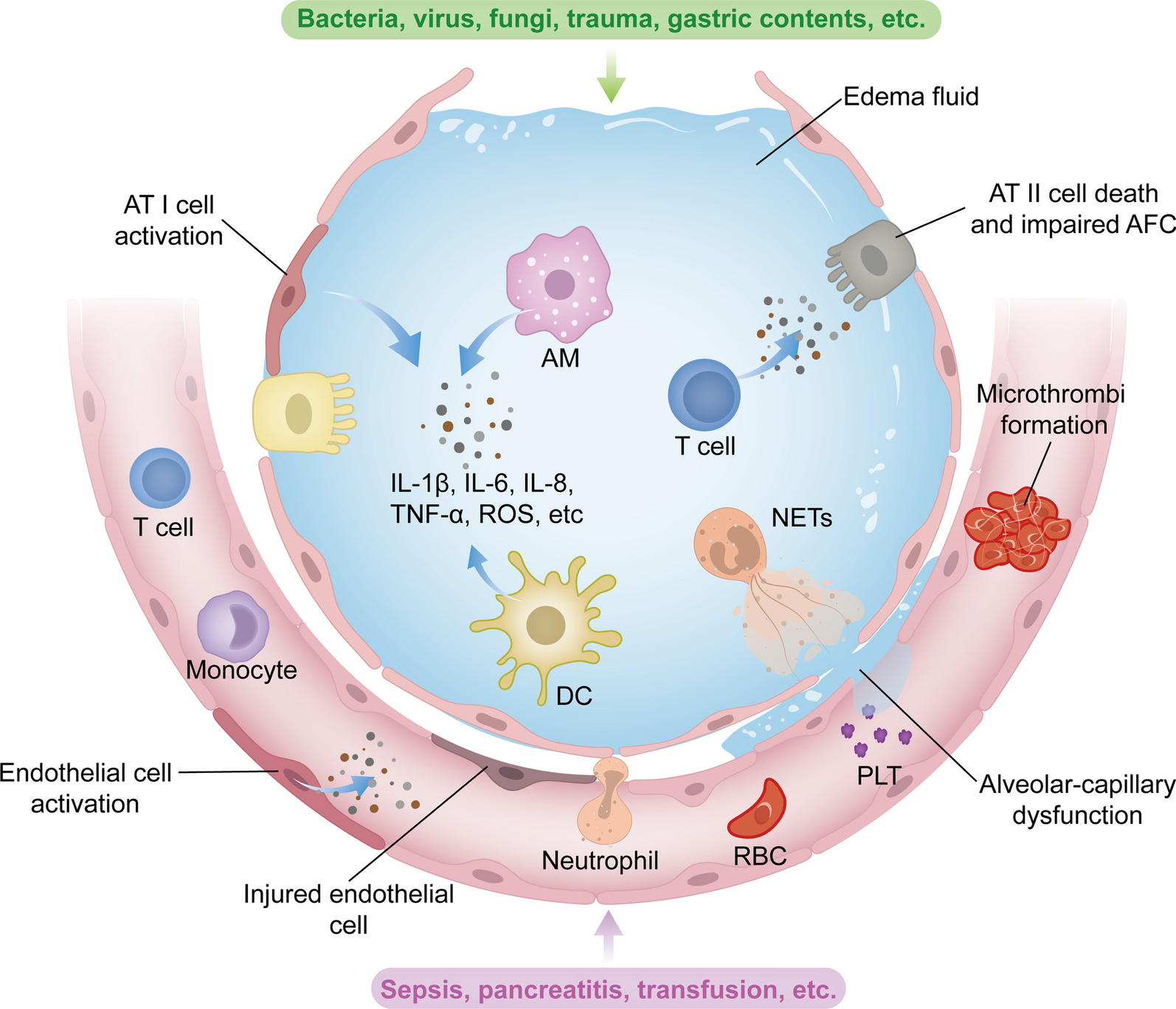 Signaling pathways and potential therapeutic targets in acute respiratory distress syndrome (ARDS)
