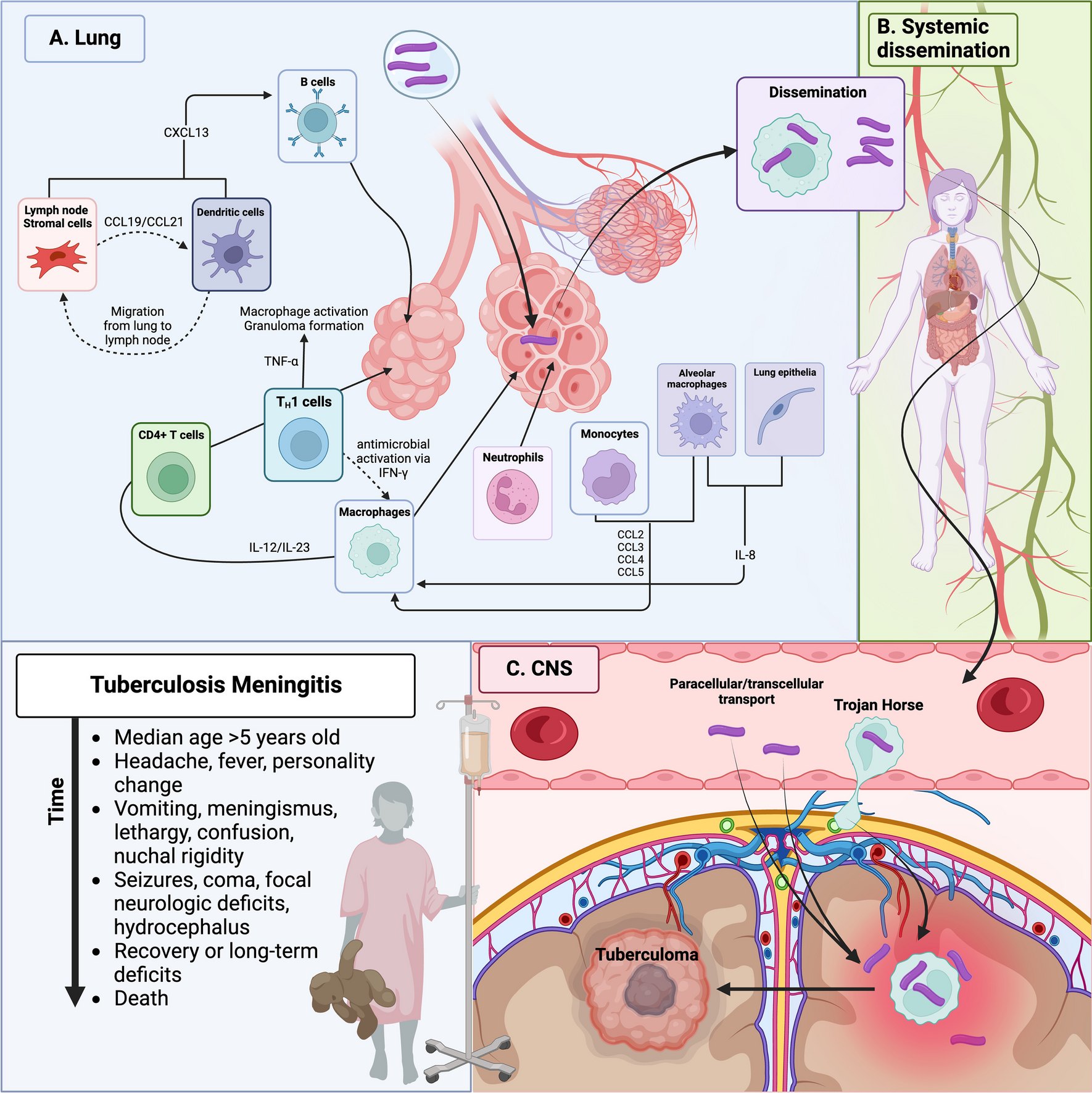 Tuberculous Meningitis: an Update on the Pathogenesis and Neuroimmunology