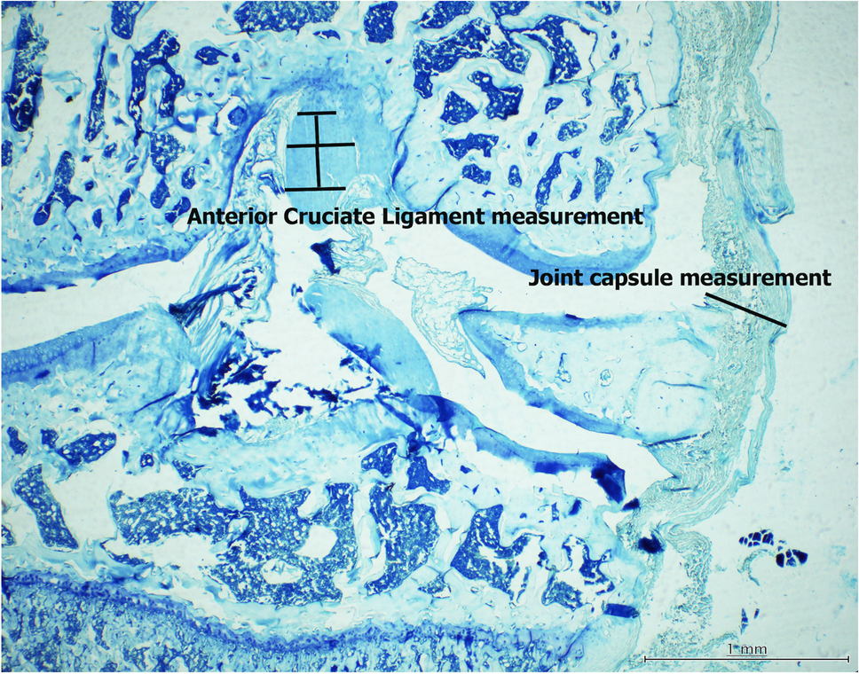 Tranexamic acid administered intraarticularly to the knee is safer for the articular cartilage and anterior cruciate ligament compared to intravenous administration: Histological analysis of an experimental rat model