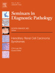 IgG4-related lymphadenopathy