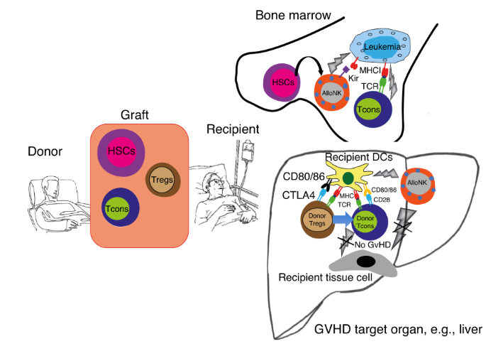 How adoptive transfer of components of the donor immune system boosts GvL and prevents GvHD in HLA-haploidentical hematopoietic transplantation for acute leukemia