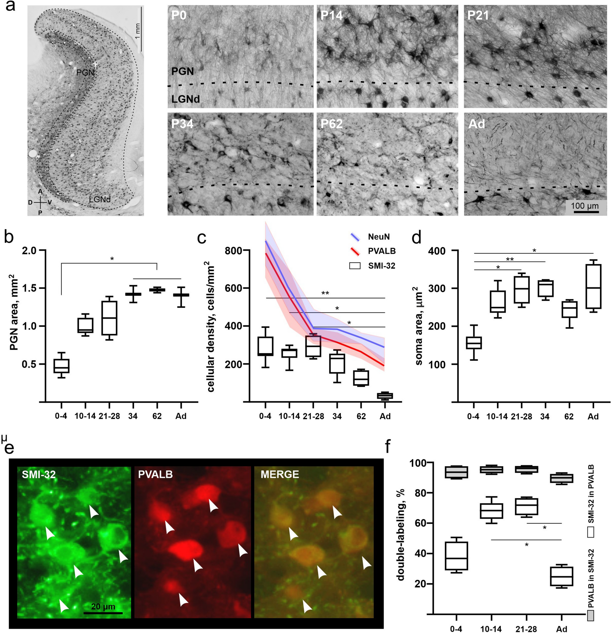 Transient expression of heavy-chain neurofilaments in the perigeniculate nucleus of cats