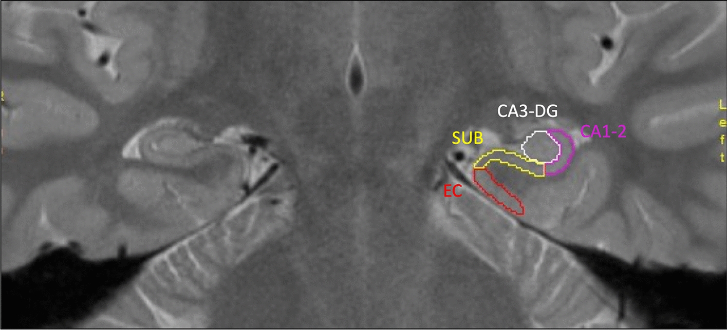 KIBRA single nucleotide polymorphism is associated with hippocampal subfield volumes and cognition across development