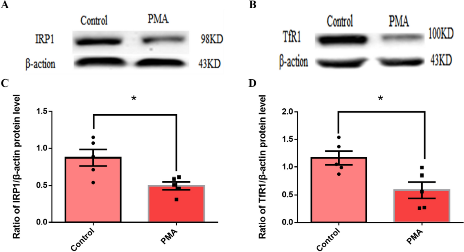 Contrasting Iron Metabolism in Undifferentiated Versus Differentiated MO3.13 Oligodendrocytes via IL-1β-Induced Iron Regulatory Protein 1
