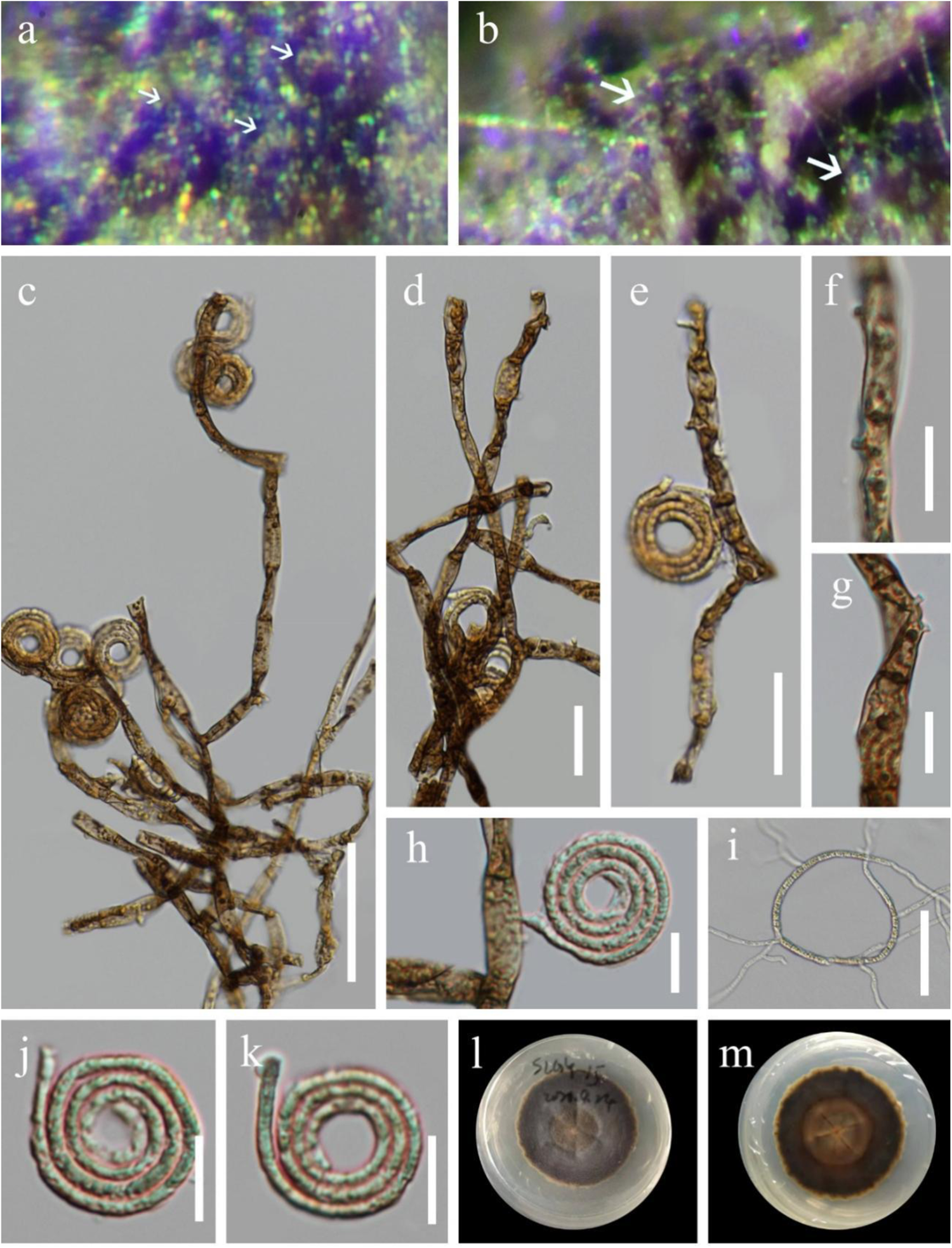 Polyketides from Neohelicosporium griseum: structure assignment and bioactivity investigation