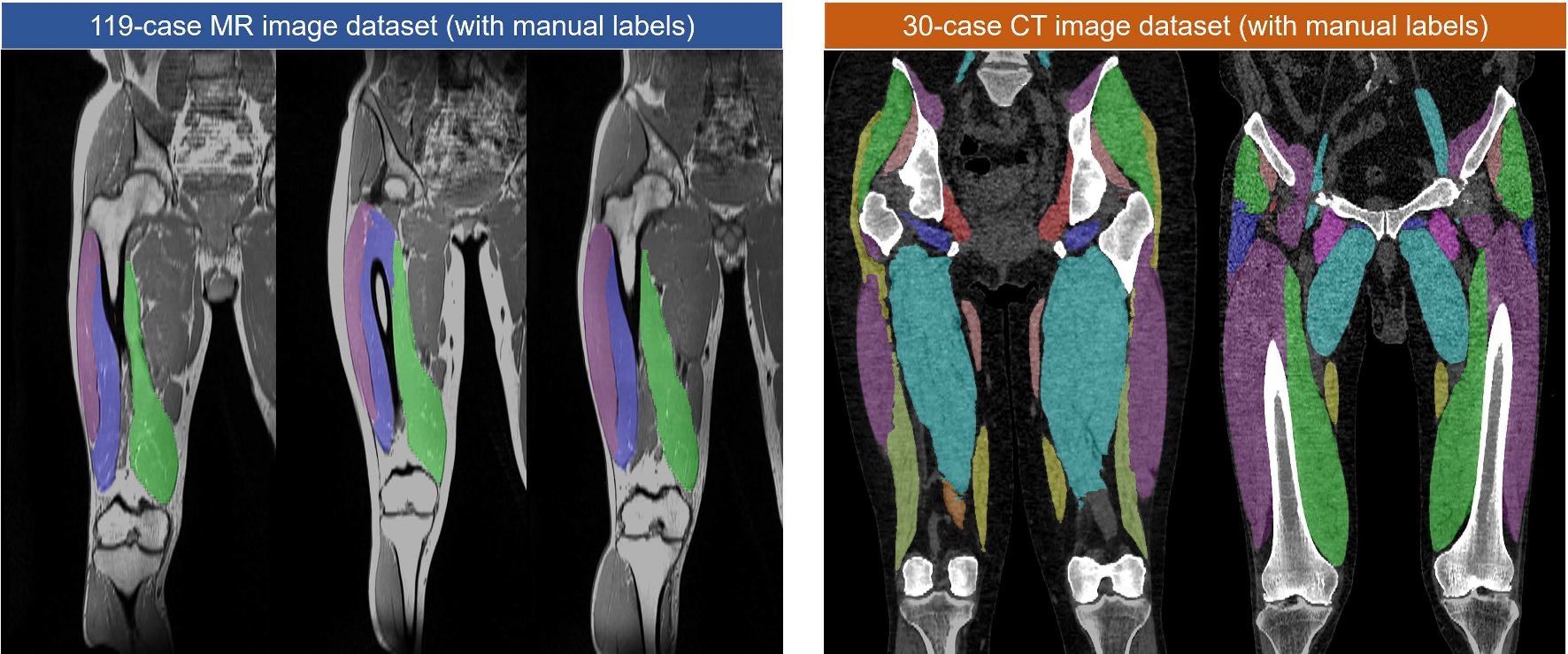 Hybrid representation-enhanced sampling for Bayesian active learning in musculoskeletal segmentation of lower extremities