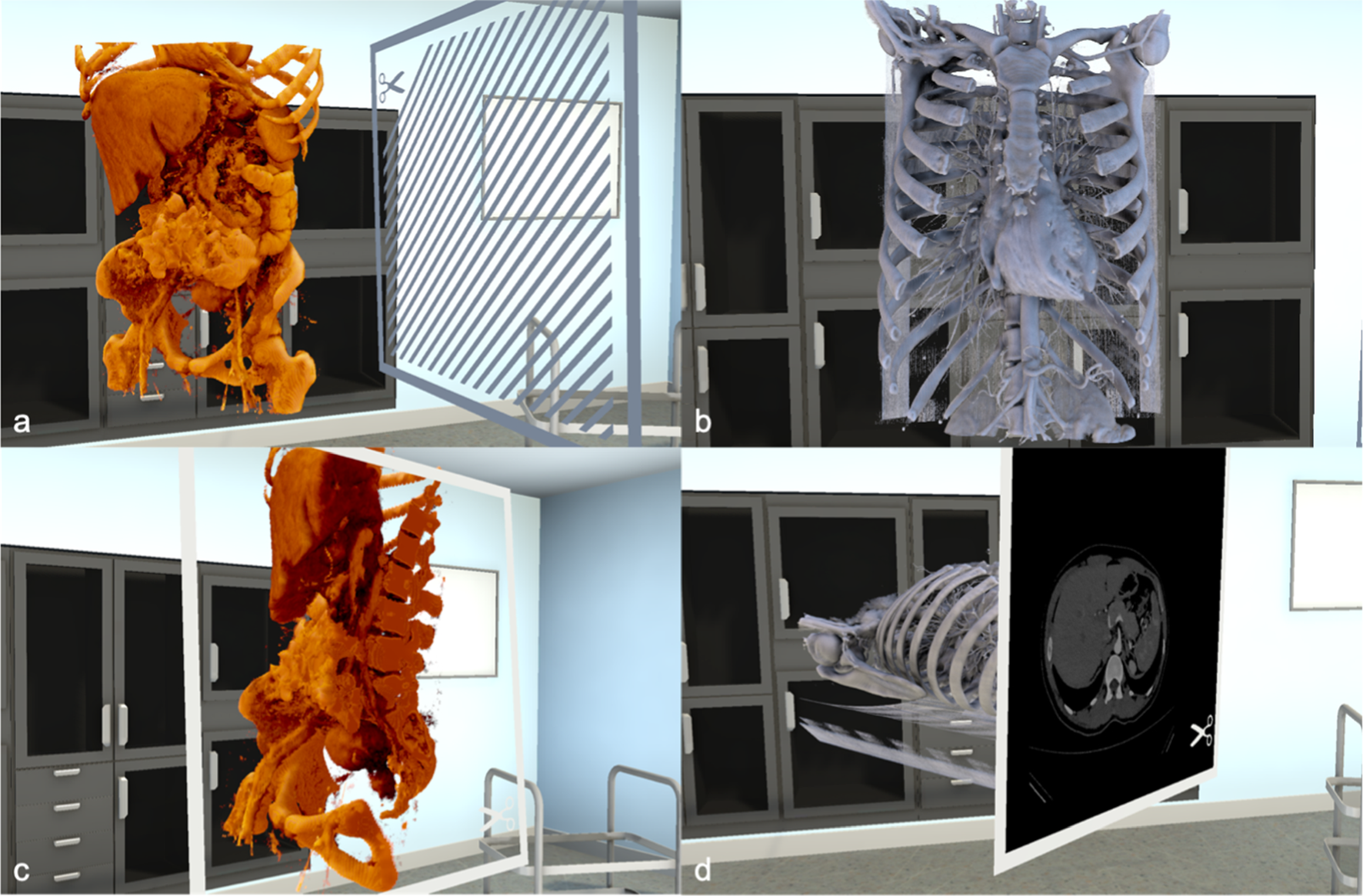 Assessment of resectability of pancreatic cancer using novel immersive high-performance virtual reality rendering of abdominal computed tomography and magnetic resonance imaging
