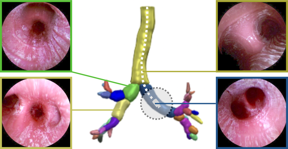 Airway label prediction in video bronchoscopy: capturing temporal dependencies utilizing anatomical knowledge