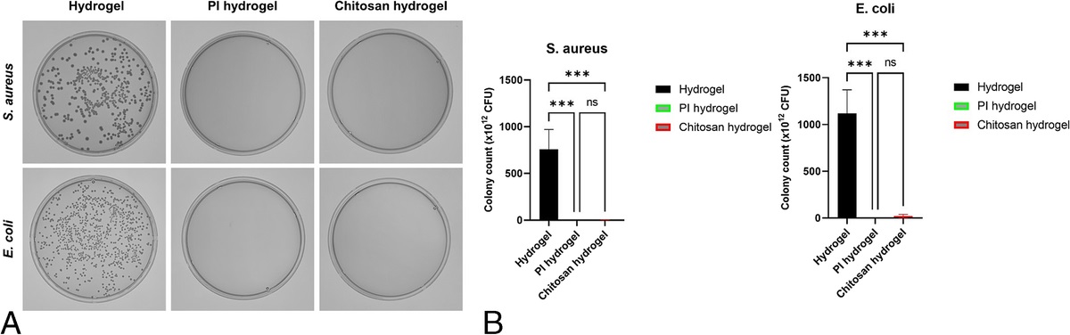 Comparative Analysis of Antibacterial and Wound Healing Activities of Chitosan and Povidone-Iodine–Based Hydrogels