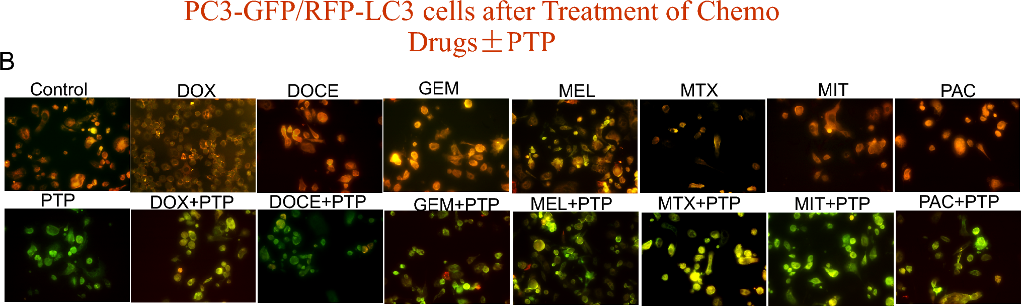 Correction to: Up-regulation of autophagy is a mechanism of resistance to chemotherapy and can be inhibited by pantoprazole to increase drug sensitivity