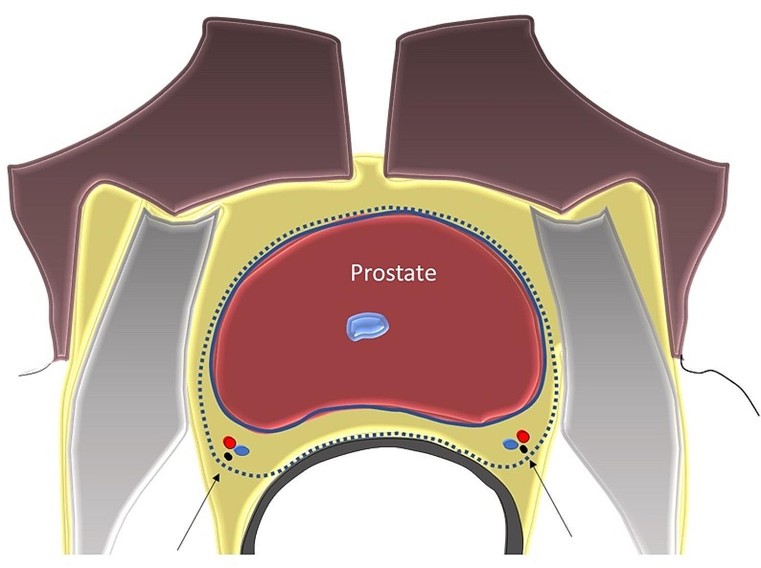 Clinical application of machine learning models in patients with prostate cancer before prostatectomy