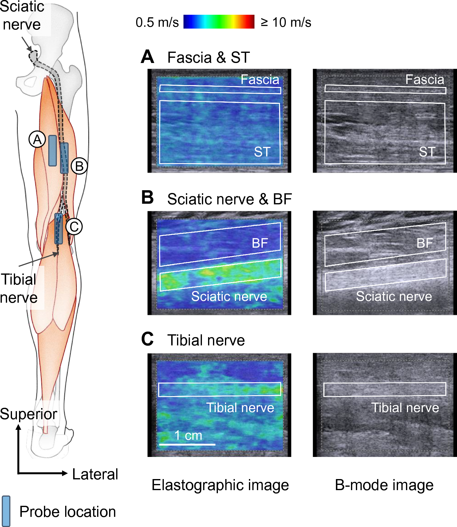 Acute effect of static stretching on non-muscular tissue stiffness and joint flexibility: a comparative study between older and young men