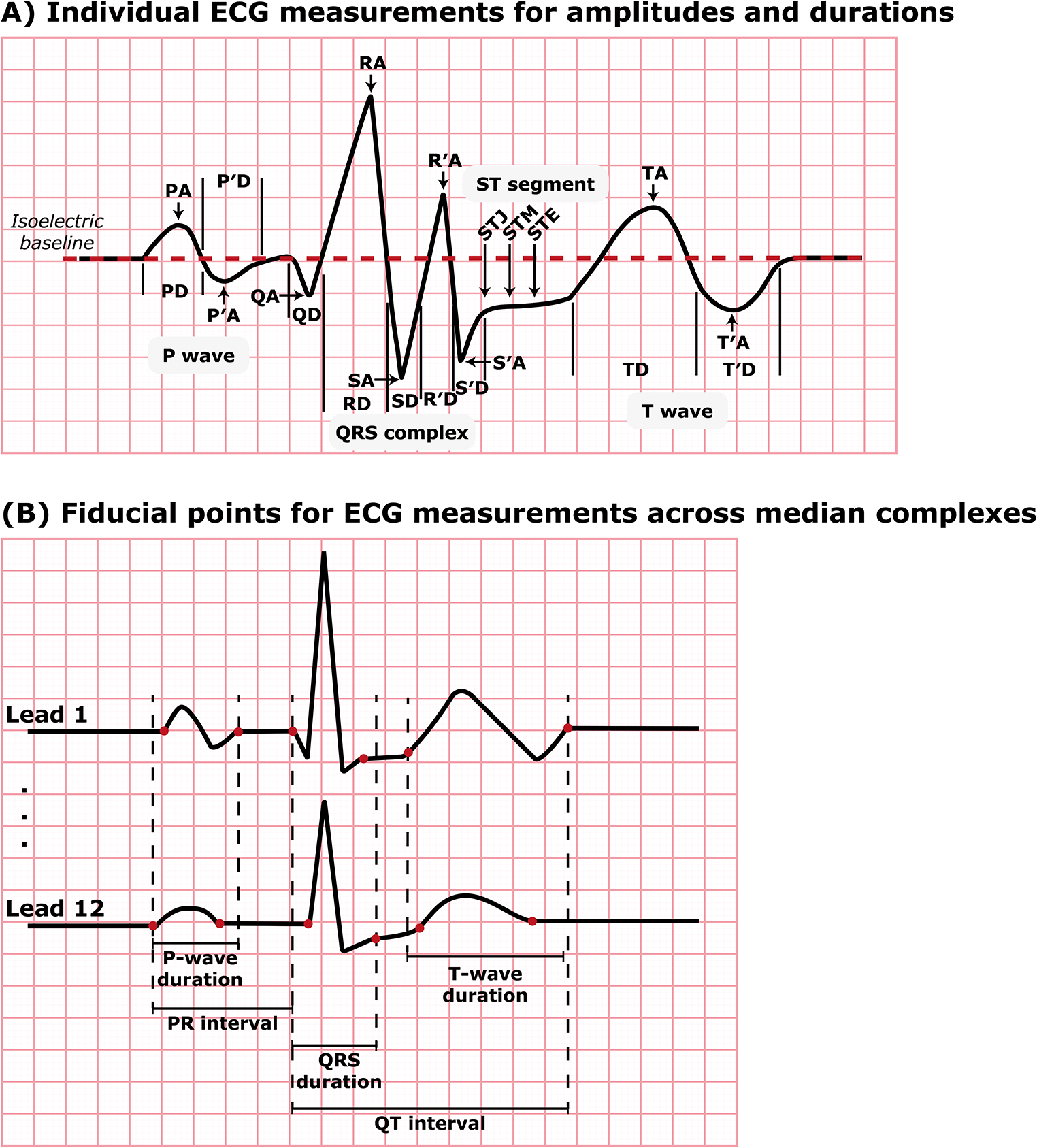 The Danish Nationwide Electrocardiogram (ECG) Cohort
