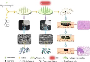 Industrializable approach for preparing hydrogel microneedles and their application in melanoma treatment