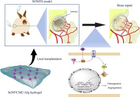 Selenium nanoparticles/carboxymethyl chitosan/alginate antioxidant hydrogel for treating steroid-induced osteonecrosis of the femoral head
