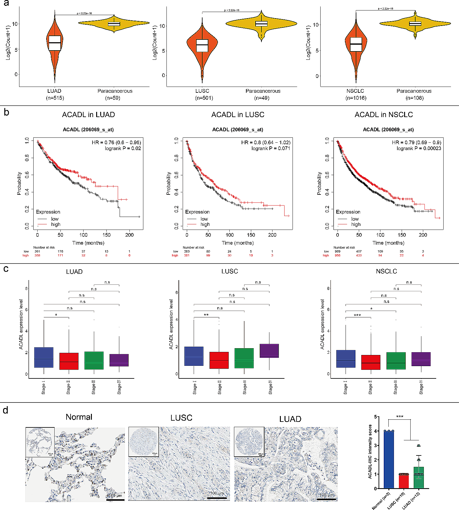 ACADL-YAP axis activity in non-small cell lung cancer carcinogenicity