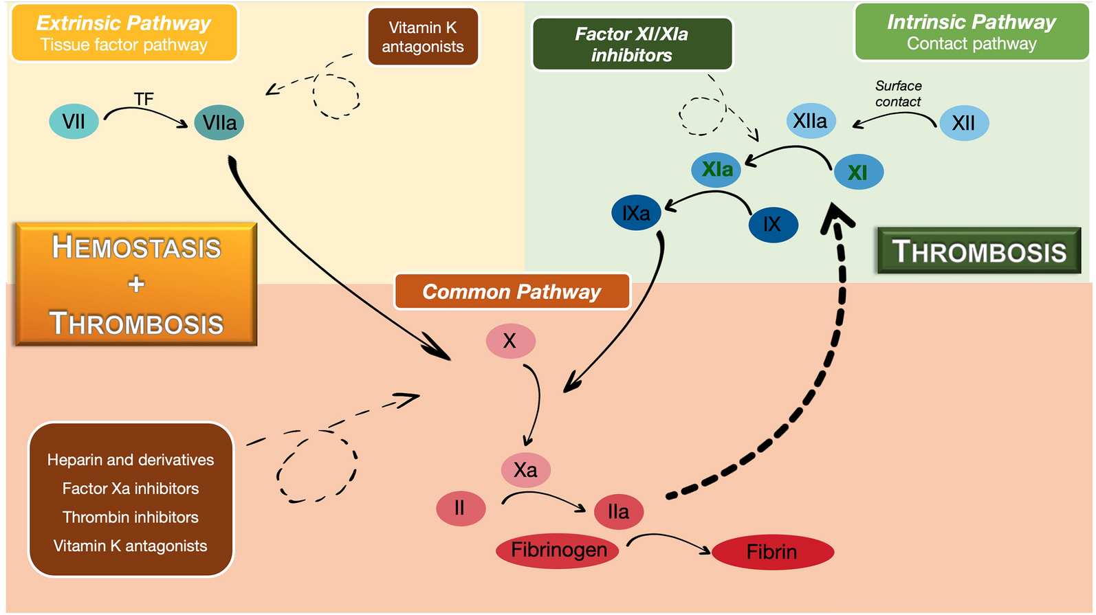 Factor XI Inhibitors: A New Horizon in Anticoagulation Therapy