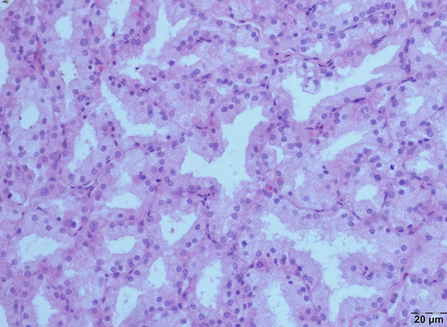 The influencer effect of Dexmedetomidine on radioiodine relevant to lacrimal gland impairment