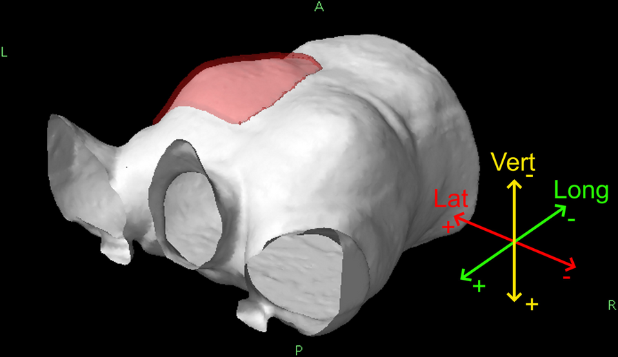 Interfractional variation in whole-breast VMAT irradiation: a dosimetric study with complementary SGRT and CBCT patient setup