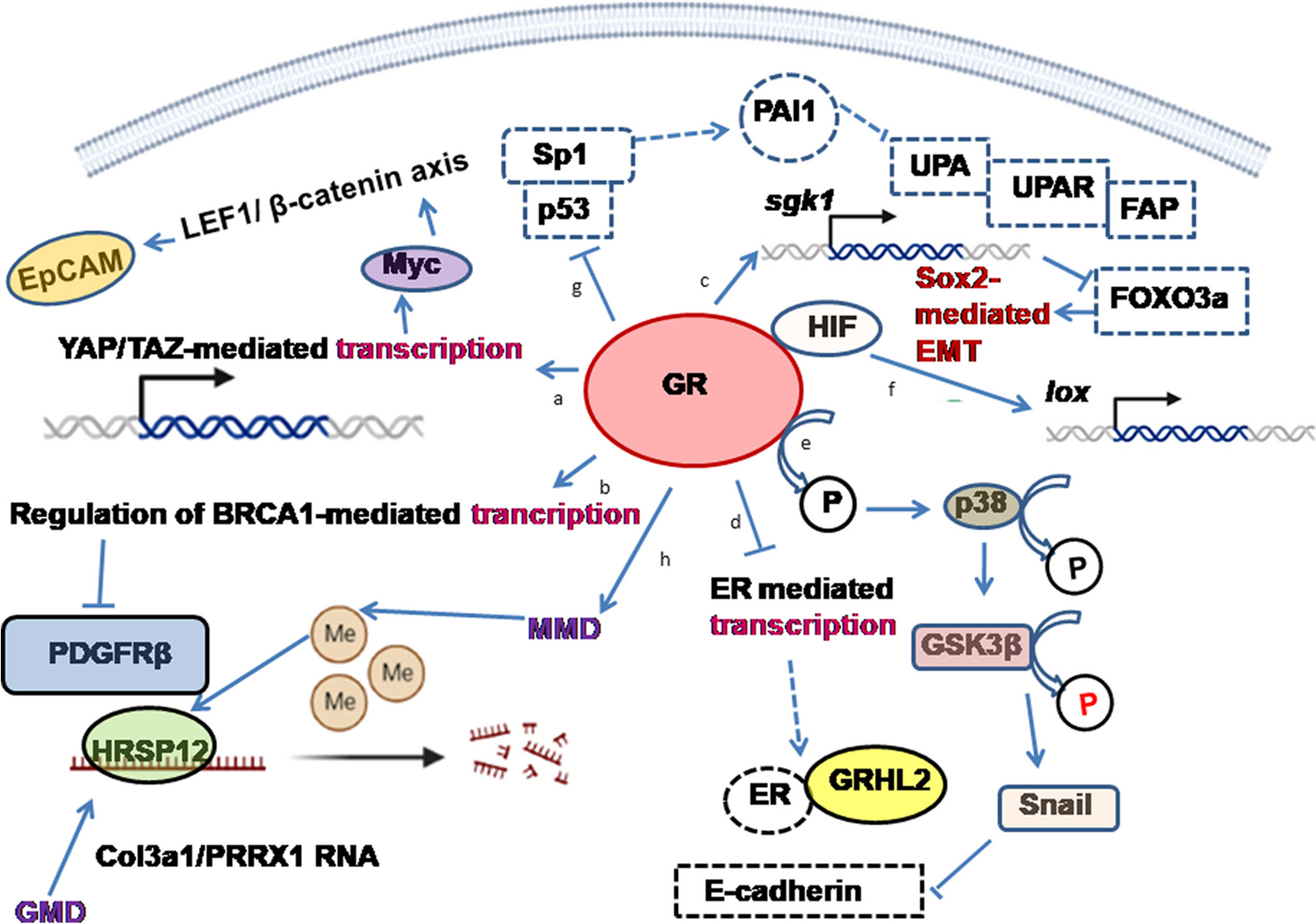 Glucocorticoid receptor: a harmonizer of cellular plasticity in breast cancer—directs the road towards therapy resistance, metastatic progression and recurrence