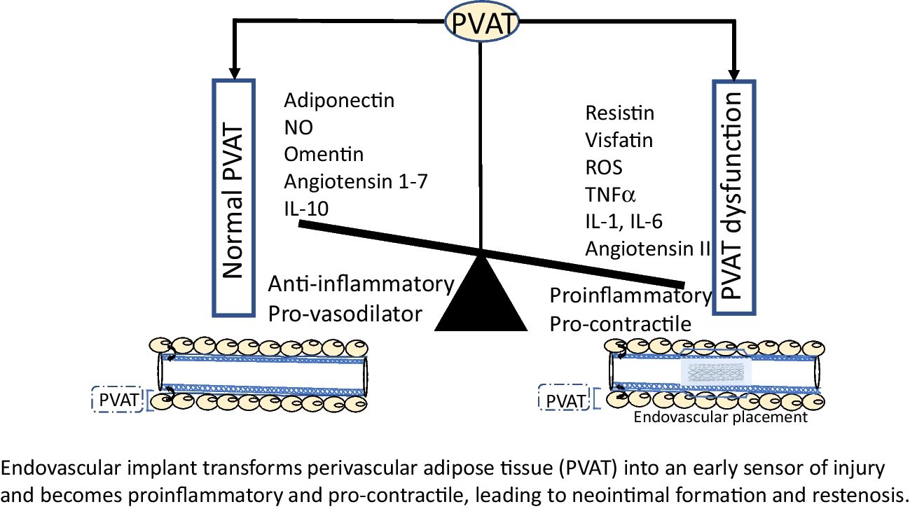 Impact of Perivascular Adipose Tissue on Neointimal Formation Following Endovascular Placement