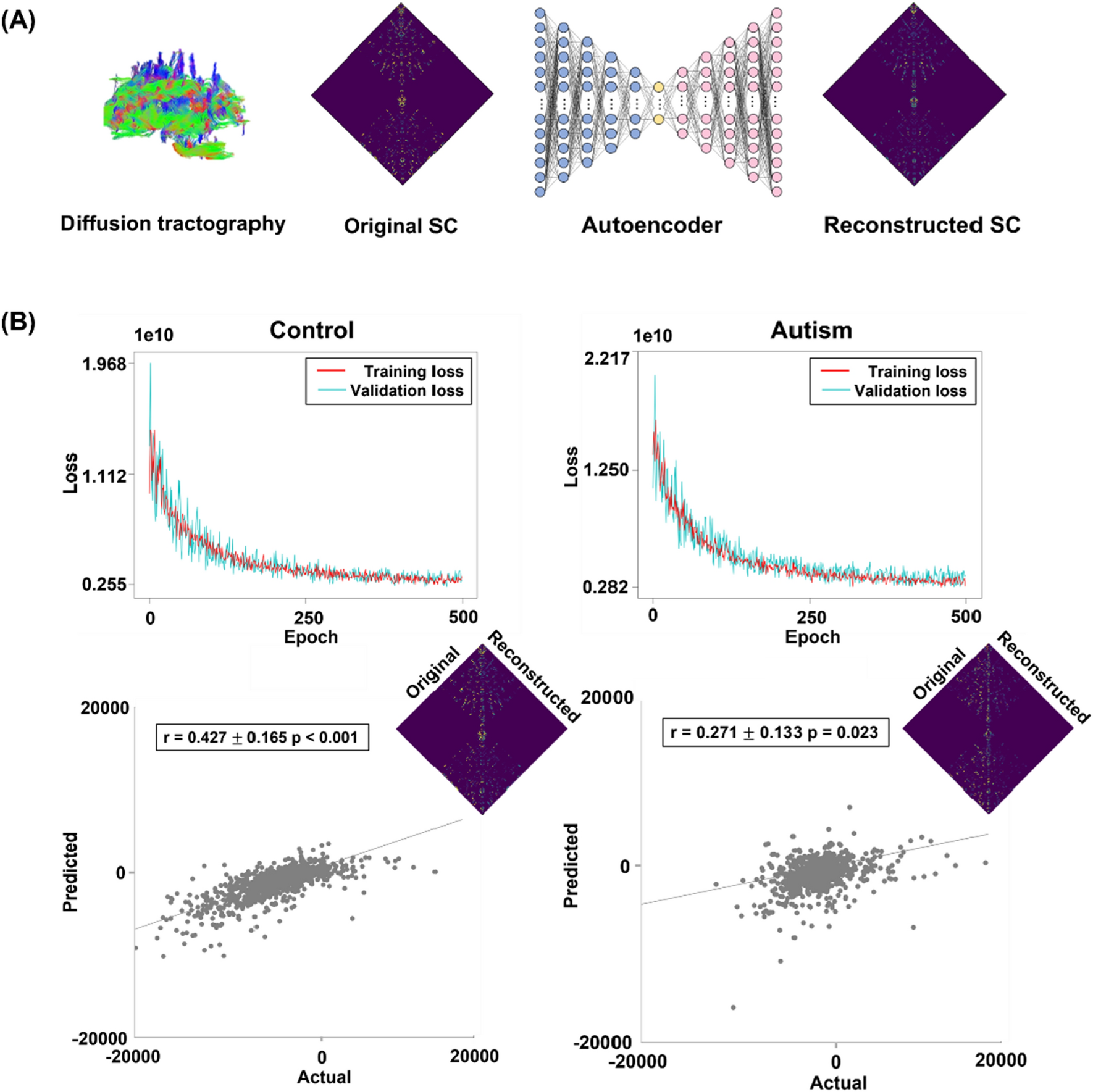 Structural connectome alterations between individuals with autism and neurotypical controls using feature representation learning