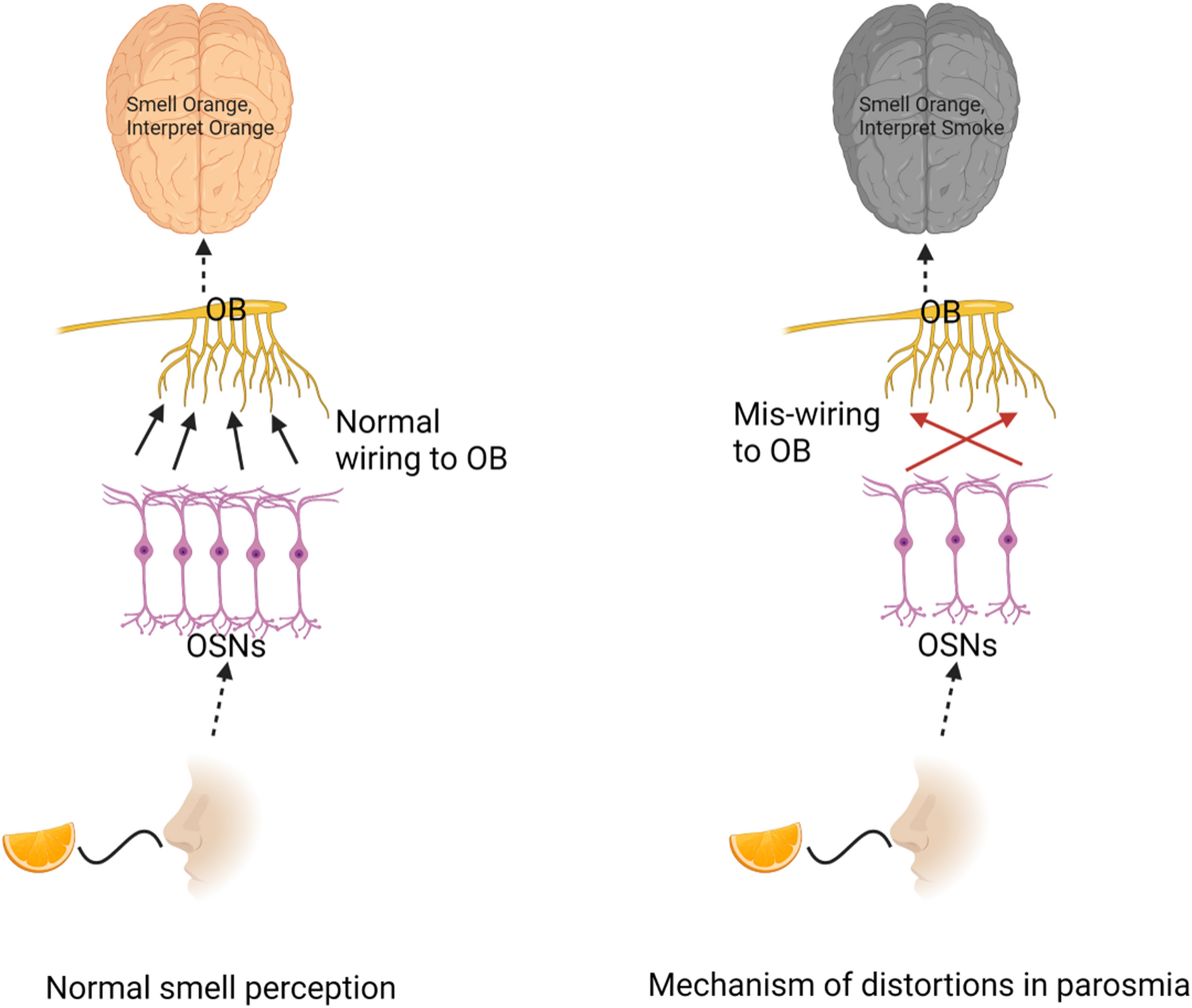 Functional connectivity patterns in parosmia