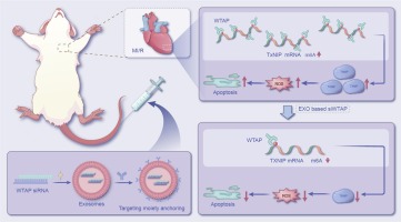 Exosome-based WTAP siRNA delivery ameliorates myocardial ischemia-reperfusion injury