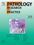 Uncommon diagnosis of multinodular goiter – isolated extrapulmonary manifestation of sarcoidosis in thyroid gland (scientific case reports)