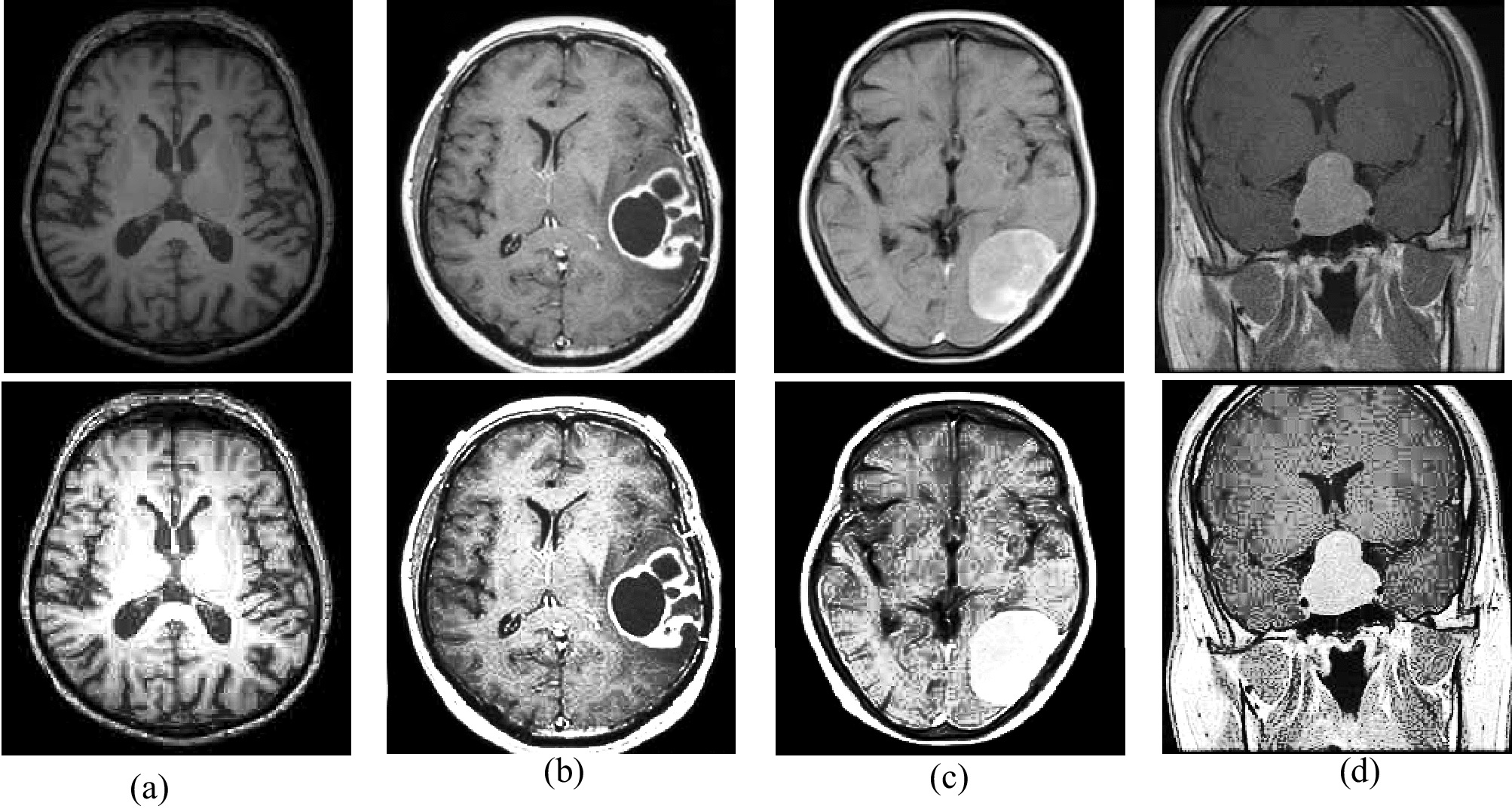 Low-grade magnetic resonance image enhancement using adaptive sigmoid transformation function